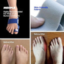 MEXPLE ToeXpacer Adjustable Bunion Corrector